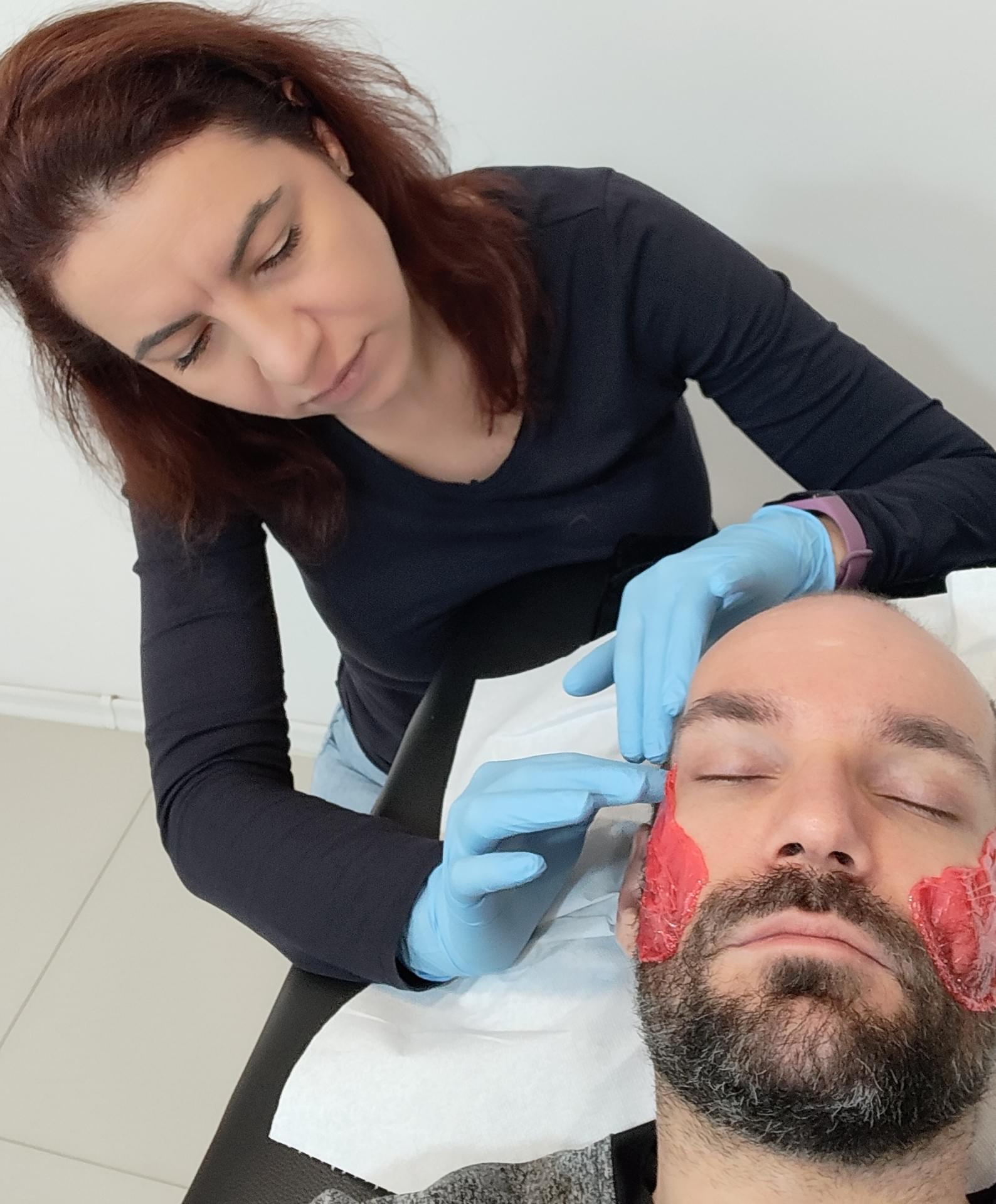 Epilare barbă profesională